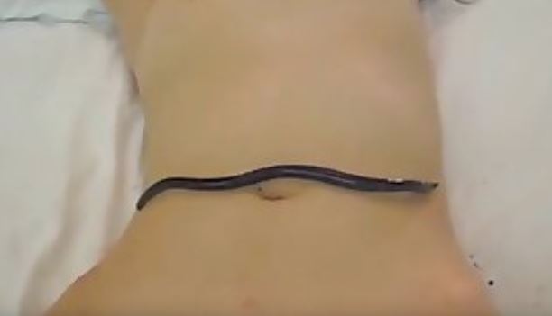 Worms In Asian Motherless com.mp4